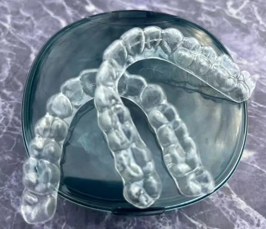 成年人矯正牙齒的三大「後遺癥」！