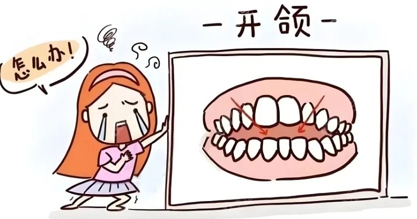 开颌