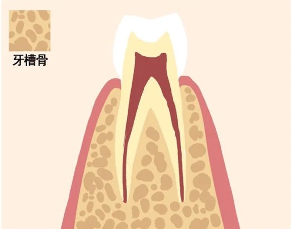 牙槽骨太薄为什么不适合做正畸？_3_牙齿矫正谌忠祚医生_来自小红书网页版
