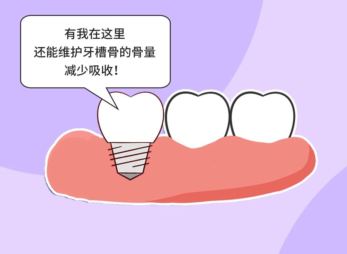 种植牙的优点_3_福芽_来自小红书网页版