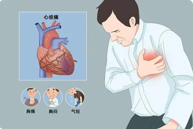 四种常见心血管疾病及其症状和预防方法_1_瑞枫盛达-医疗器械_来自小红书网页版
