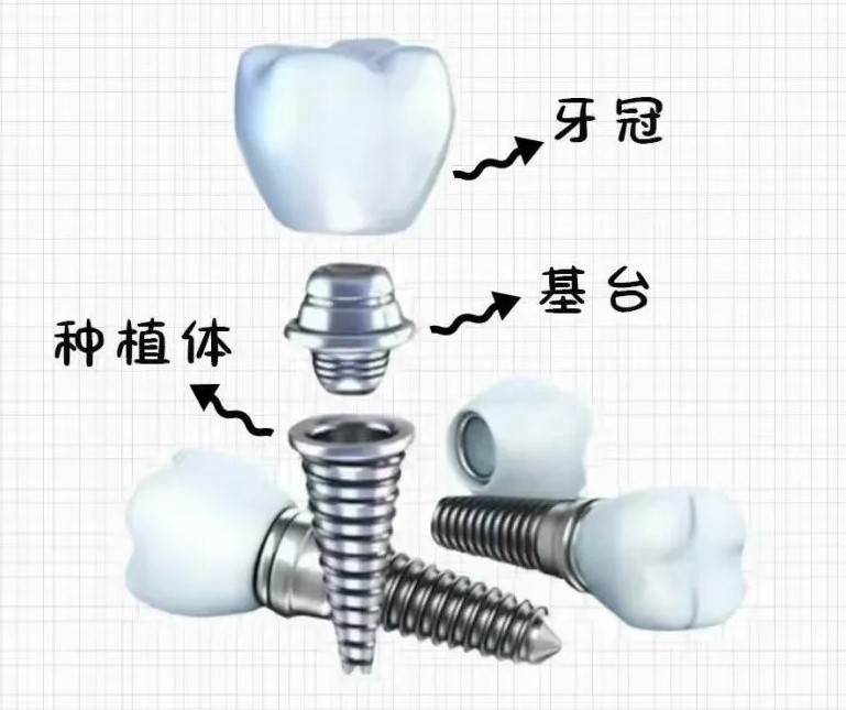_1_小红薯64EEFC99_来自小红书网页版