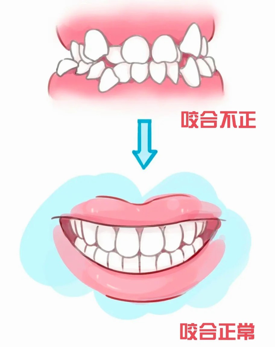 牙齿咬合不正究竟有什么危害？_1_昆明陈光第<span style=