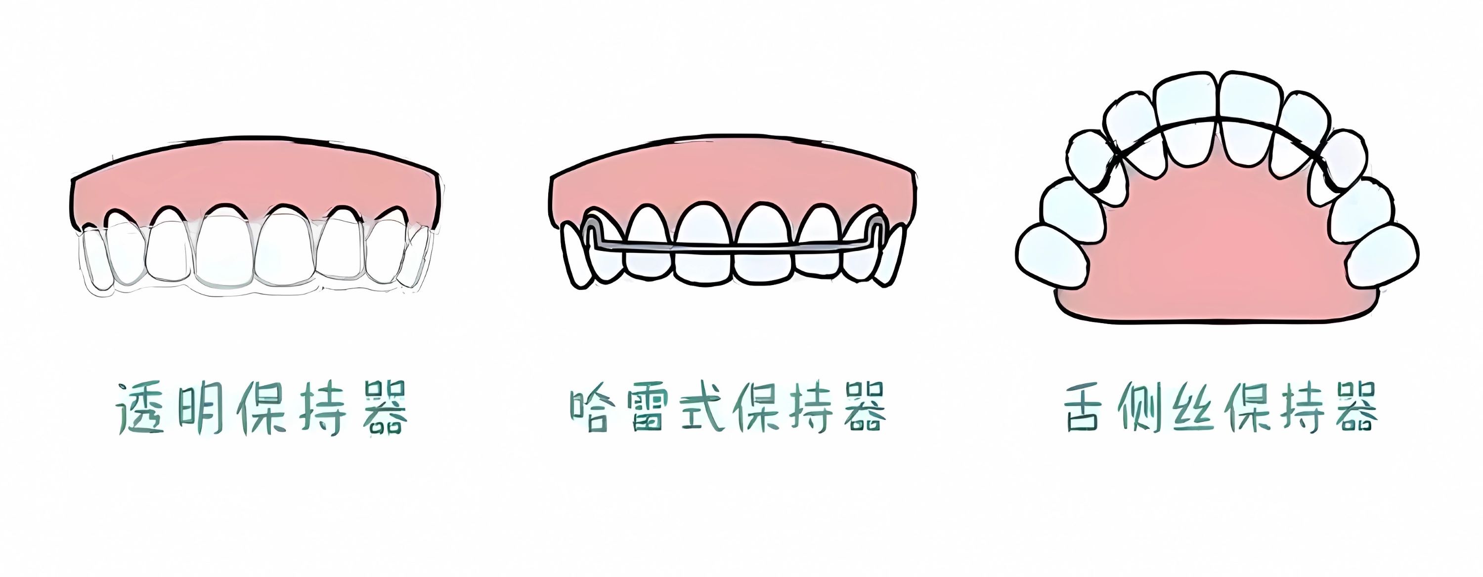 对比3种保持器优缺点，我们应该如何选？_5_牙齿矫正谌忠祚医生_来自小红书网页版 (1)
