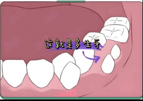 图片3
