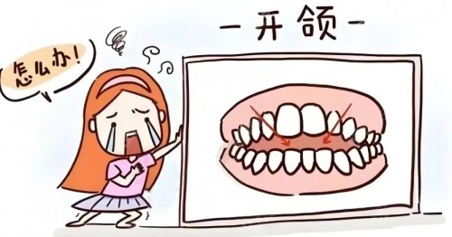 开颌