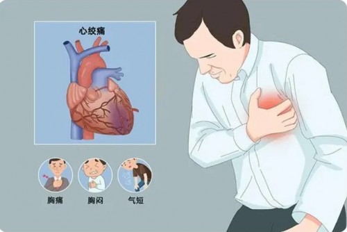四种常见心血管疾病及其症状和预防方法_1_瑞枫盛达-医疗器械_来自小红书网页版