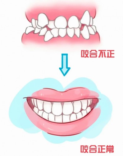 牙齿咬合不正究竟有什么危害？_1_昆明陈光第<span style=